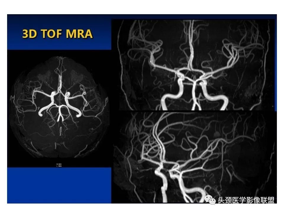 影像PPT - 【PPT】颅脑解剖及血管性病变的MRI诊断-193