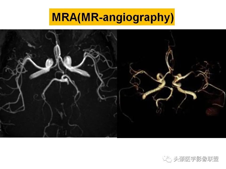 影像PPT - 【PPT】颅脑解剖及血管性病变的MRI诊断-195