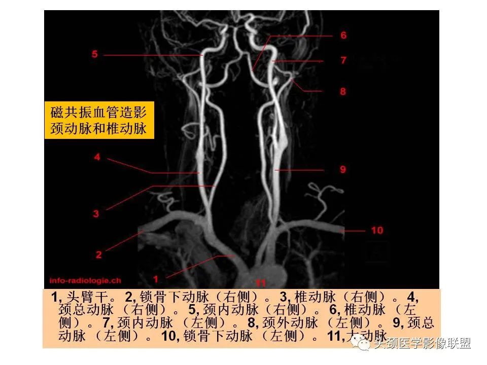 影像PPT - 【PPT】颅脑解剖及血管性病变的MRI诊断-200
