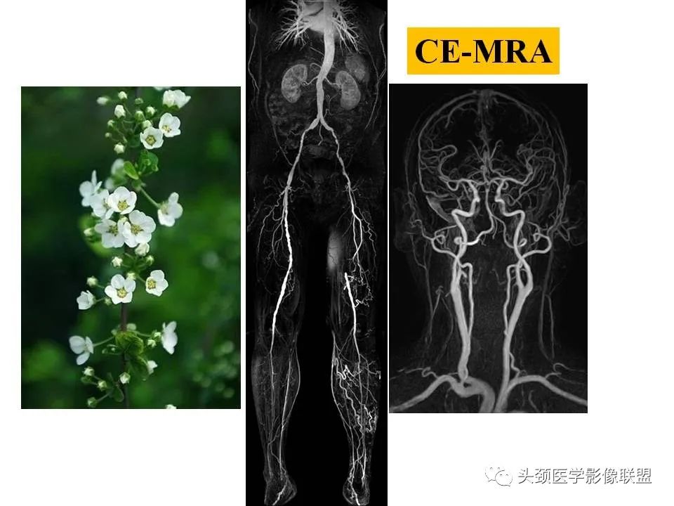 影像PPT - 【PPT】颅脑解剖及血管性病变的MRI诊断-201