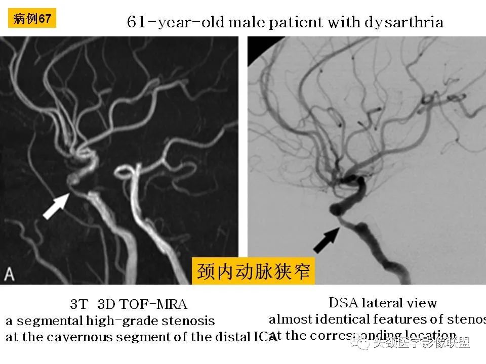 影像PPT - 【PPT】颅脑解剖及血管性病变的MRI诊断-202