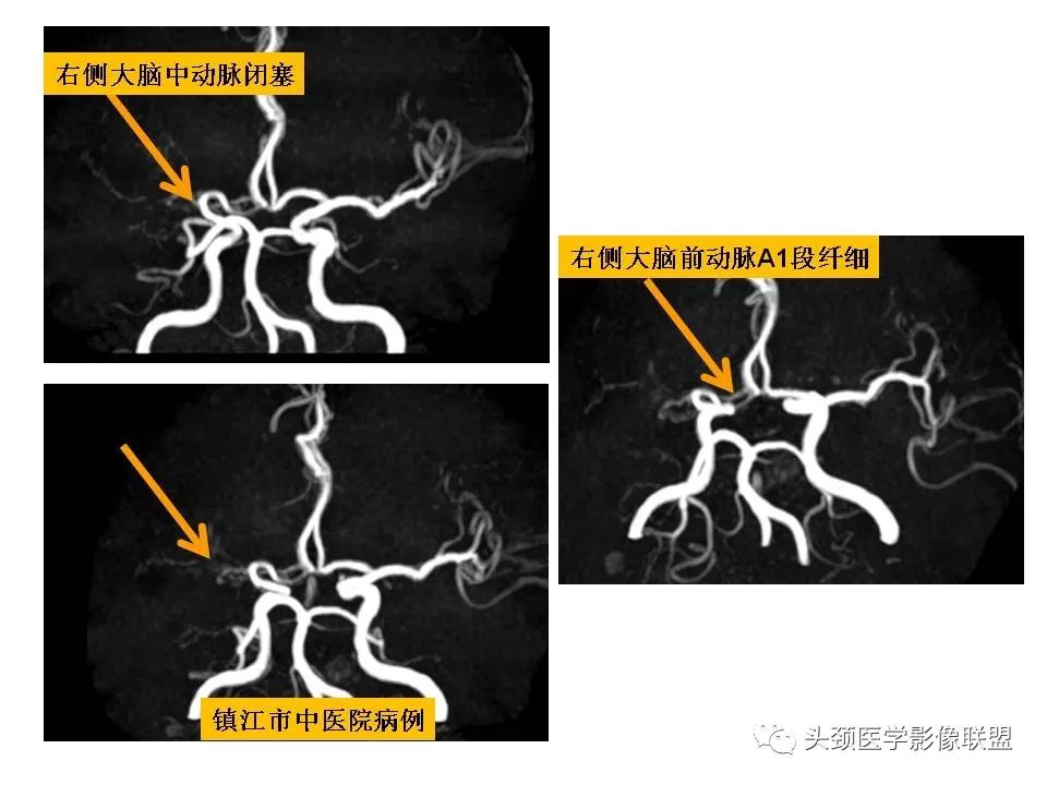影像PPT - 【PPT】颅脑解剖及血管性病变的MRI诊断-220