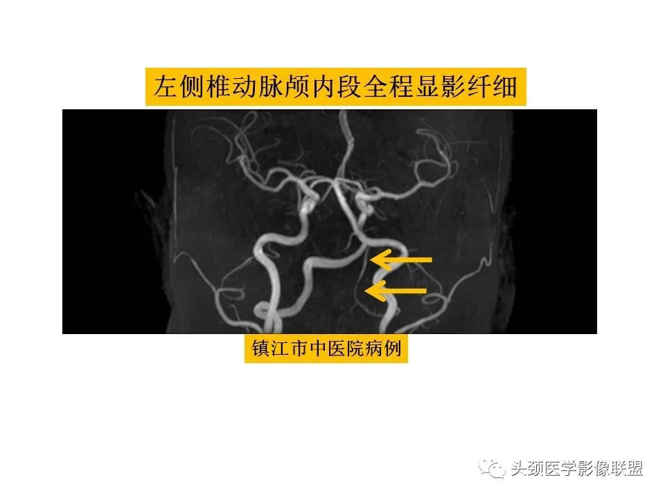 影像PPT - 【PPT】颅脑解剖及血管性病变的MRI诊断-221