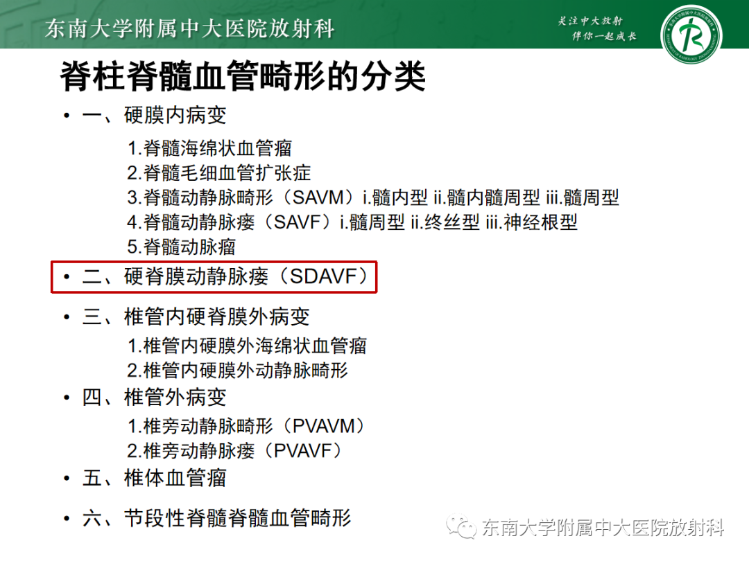 影像PPT - 【PPT】硬脊膜动静脉瘘-6
