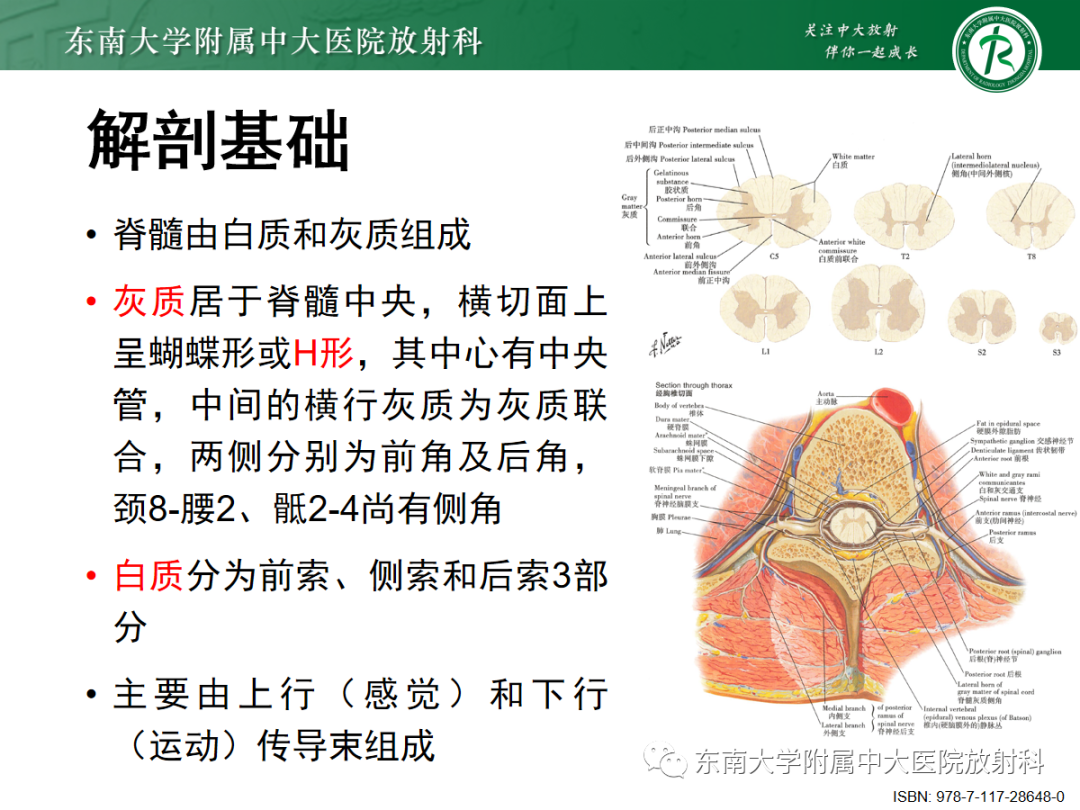 影像PPT - 【PPT】硬脊膜动静脉瘘-7