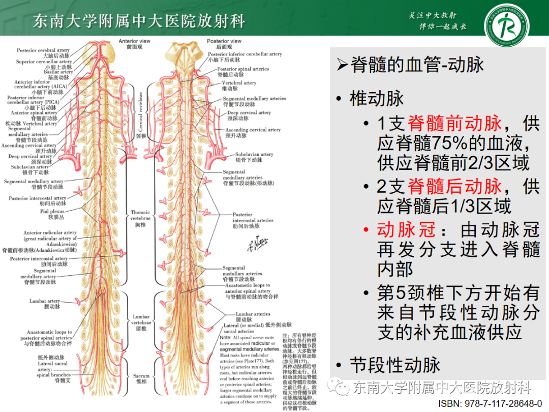 影像PPT - 【PPT】硬脊膜动静脉瘘-8