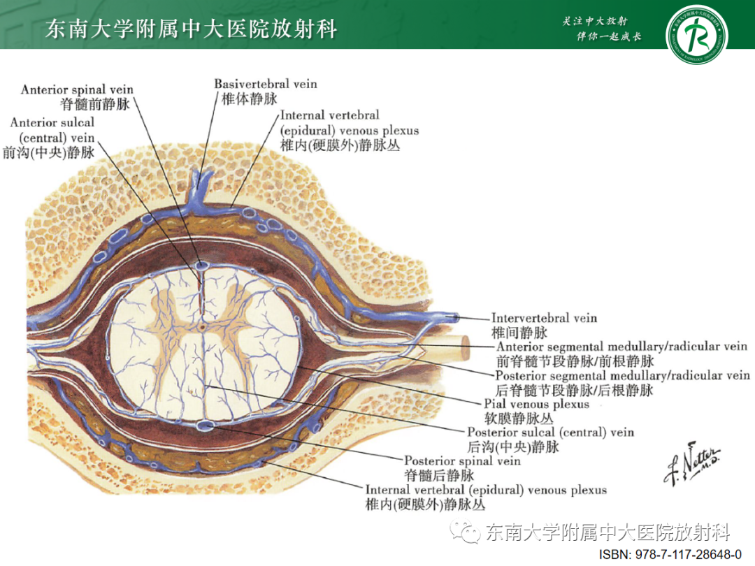 影像PPT - 【PPT】硬脊膜动静脉瘘-11