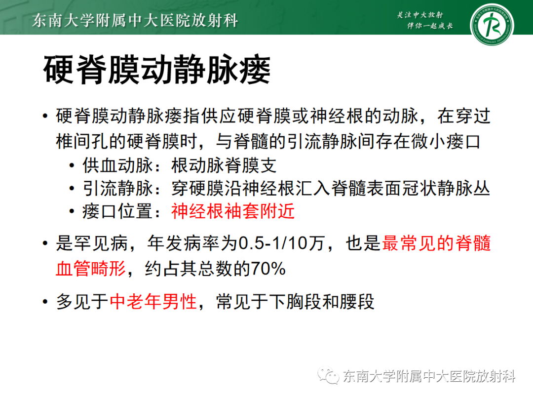 影像PPT - 【PPT】硬脊膜动静脉瘘-12