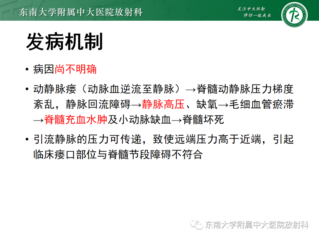 影像PPT - 【PPT】硬脊膜动静脉瘘-13