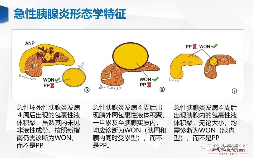 影像PPT - 【PPT】胰腺炎影像表现-25