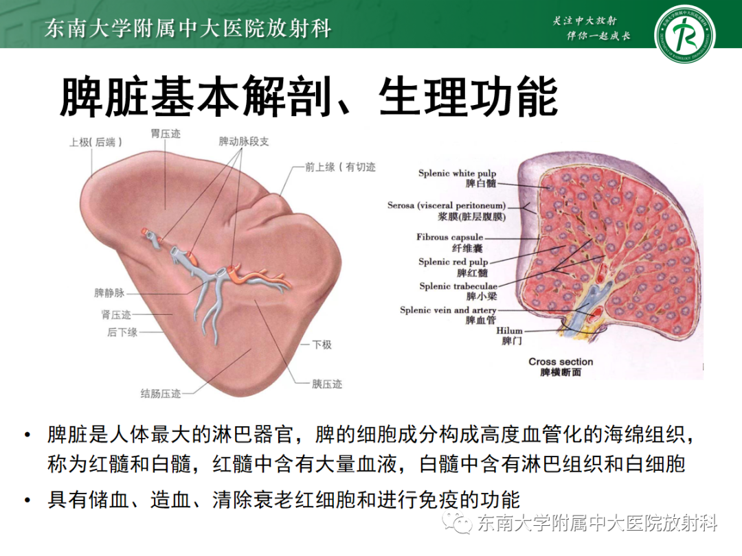 影像PPT - 【PPT】脾脏窦岸细胞血管瘤-6