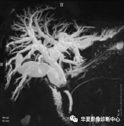 影像PPT - Mirizzi综合征的影像表现及诊断-5
