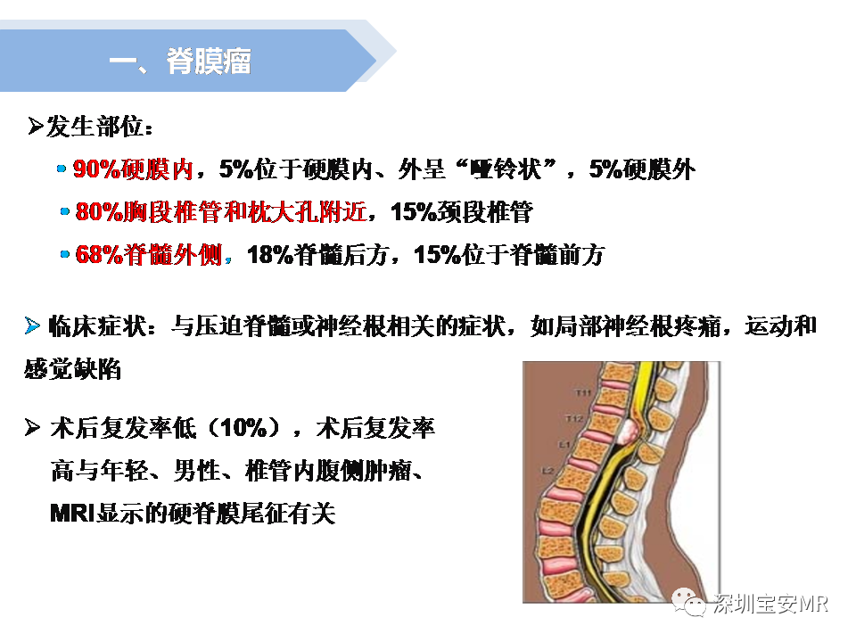 影像PPT - 【PPT】脊髓外硬膜下肿瘤的影像表现-5