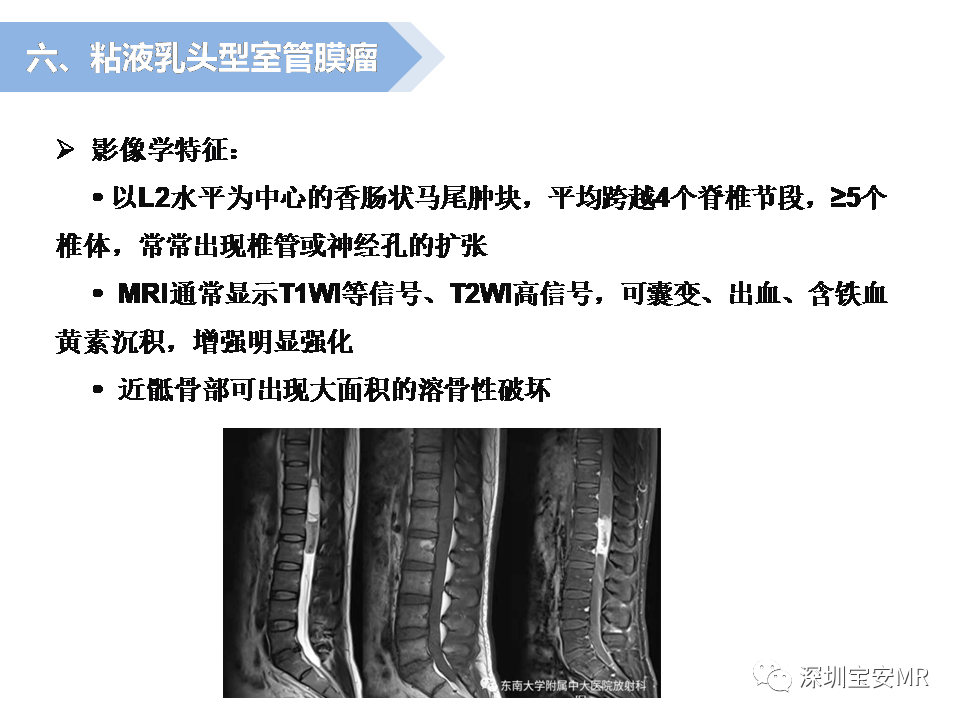 影像PPT - 【PPT】脊髓外硬膜下肿瘤的影像表现-26