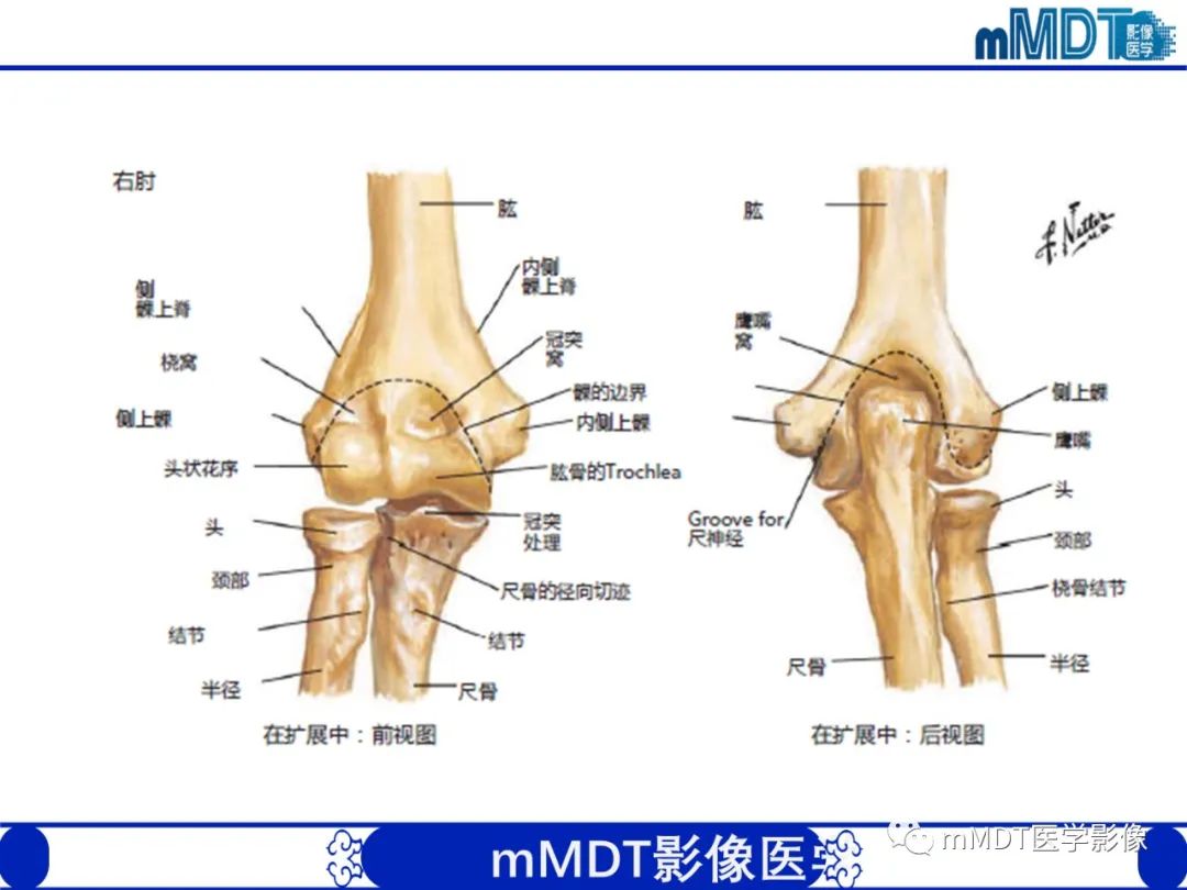 影像PPT - 【PPT】儿童肘关节损伤影像-4