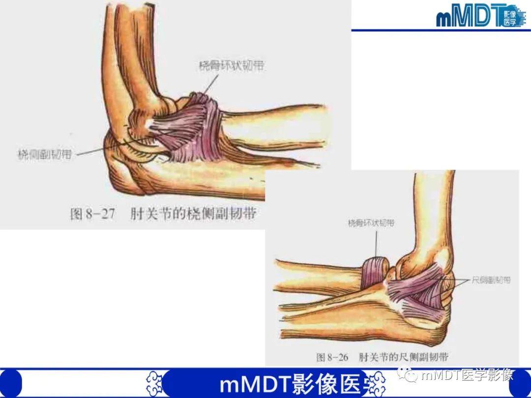 影像PPT - 【PPT】儿童肘关节损伤影像-5