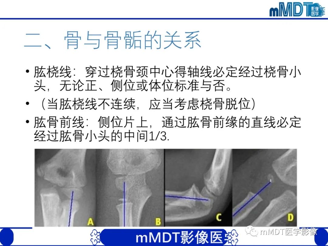 影像PPT - 【PPT】儿童肘关节损伤影像-9