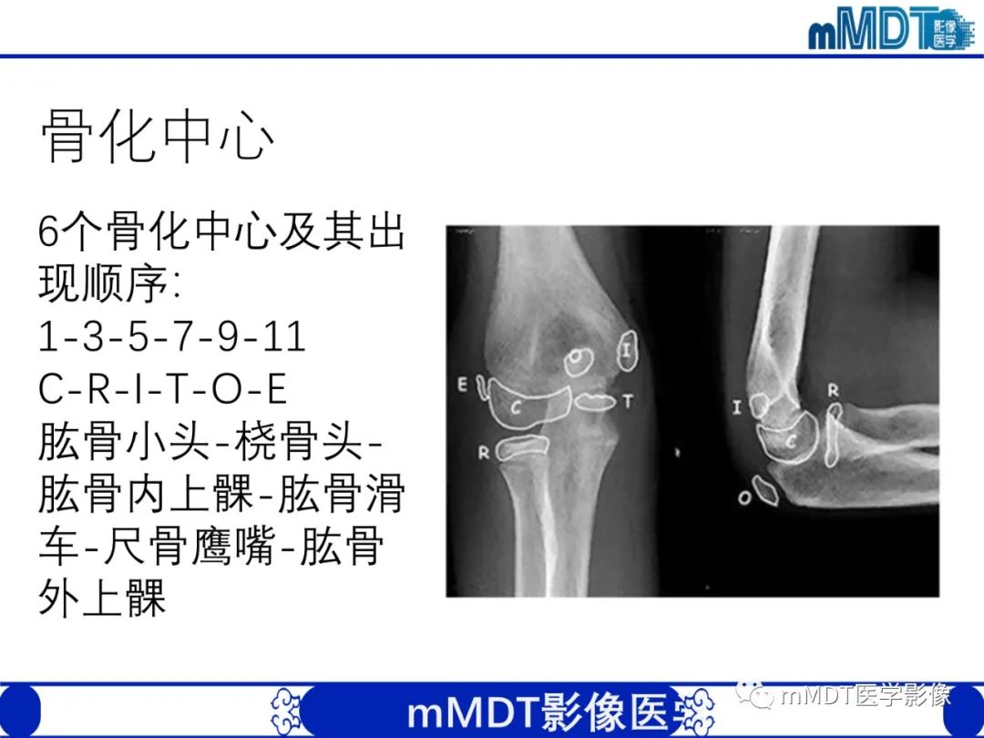 影像PPT - 【PPT】儿童肘关节损伤影像-11