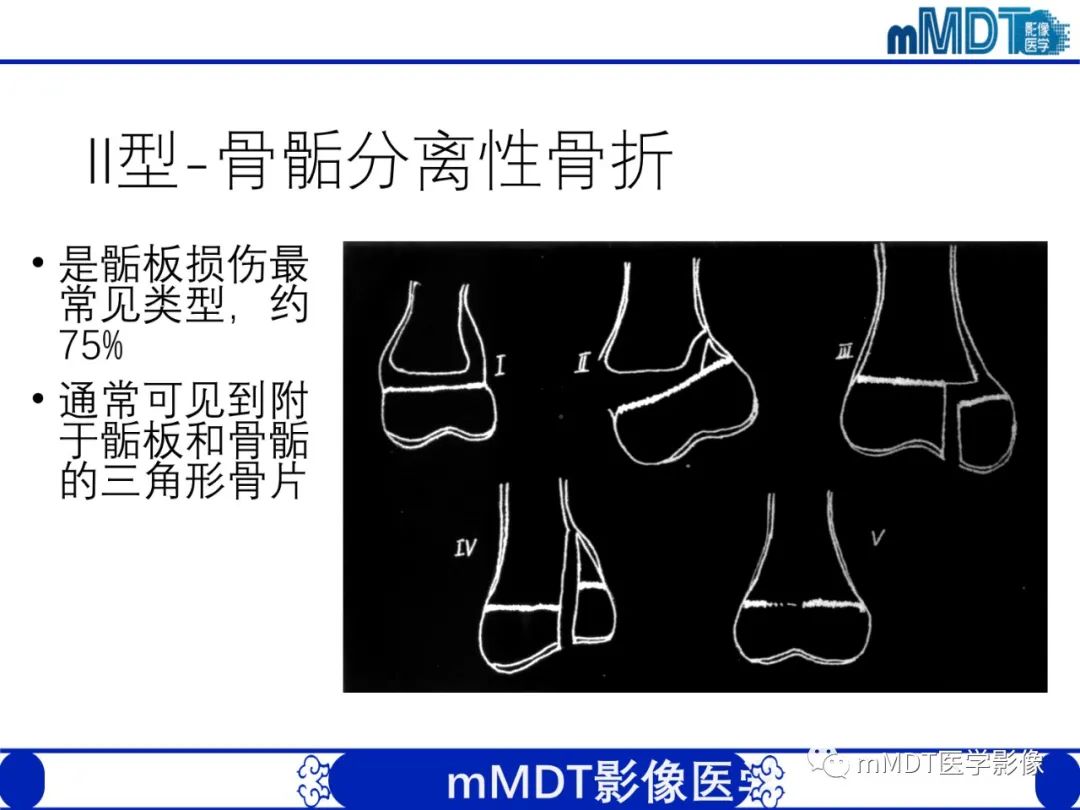影像PPT - 【PPT】儿童肘关节损伤影像-18