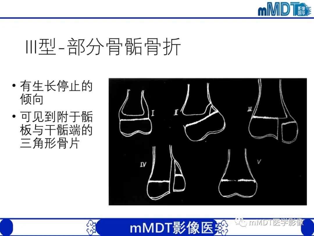 影像PPT - 【PPT】儿童肘关节损伤影像-19