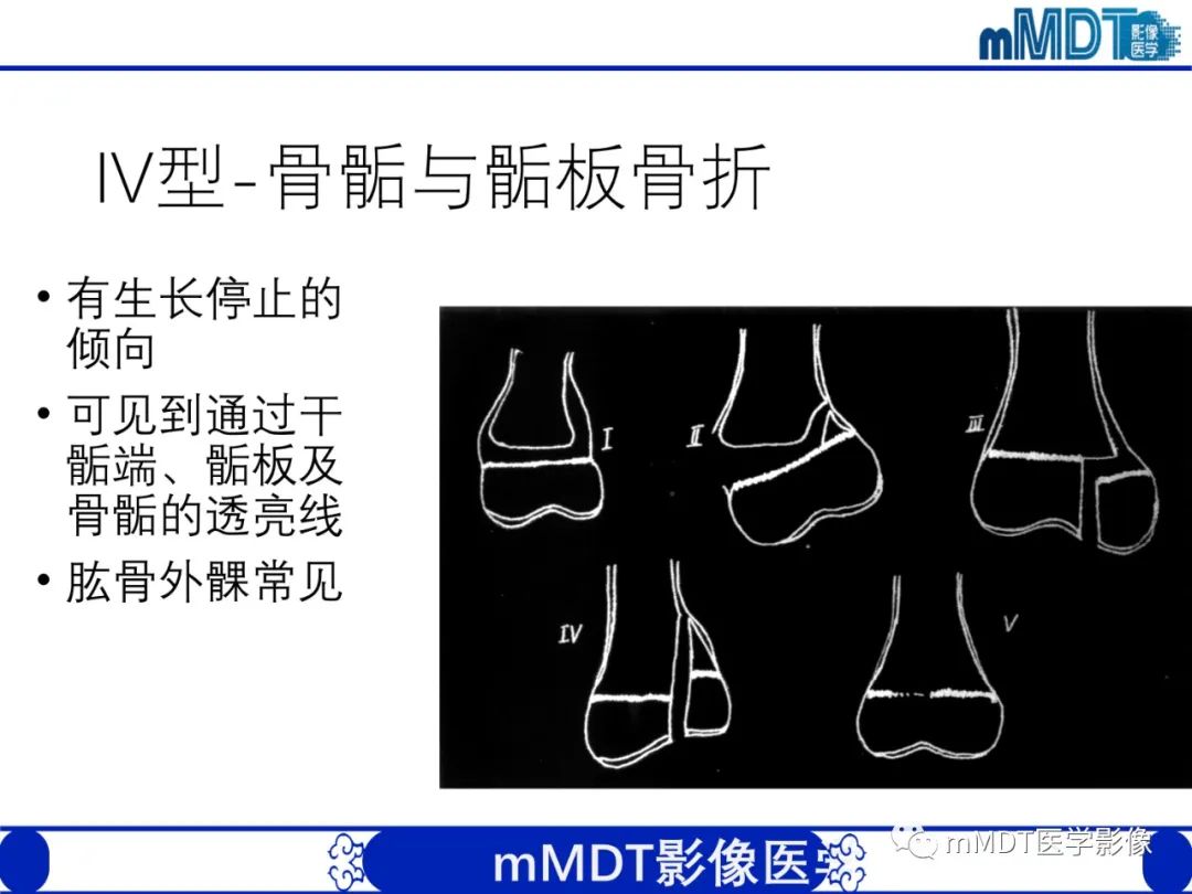 影像PPT - 【PPT】儿童肘关节损伤影像-20