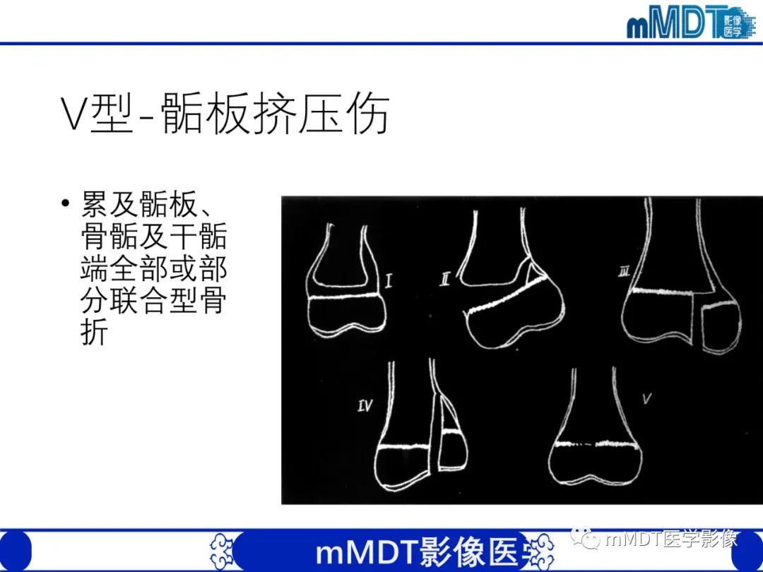 影像PPT - 【PPT】儿童肘关节损伤影像-21