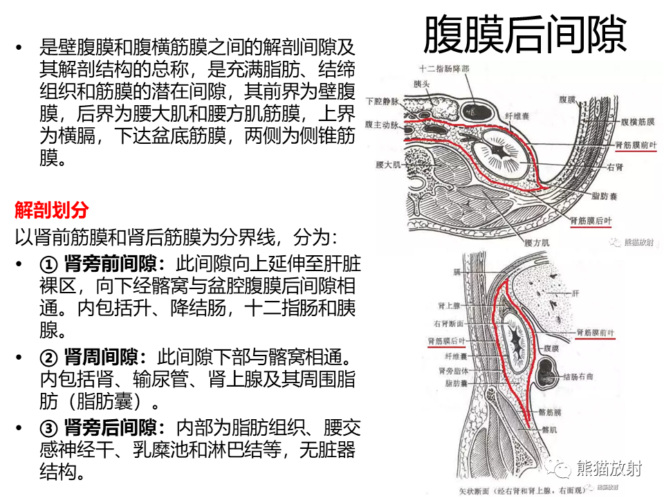 影像PPT - 【病例】副神经节瘤 VS 平滑肌肉瘤-26