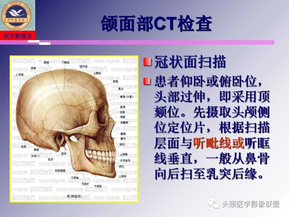影像PPT - 【PPT】颌面部影像检查方法、正常表现及颌骨骨折影像表现-18