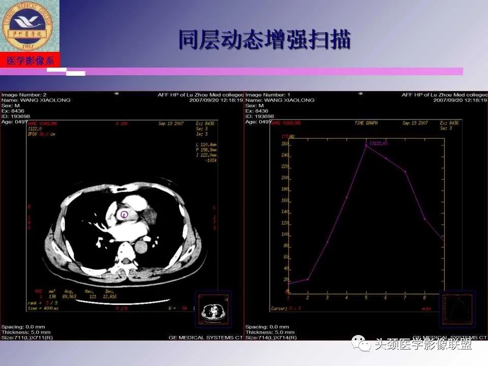 影像PPT - 【PPT】颌面部影像检查方法、正常表现及颌骨骨折影像表现-23