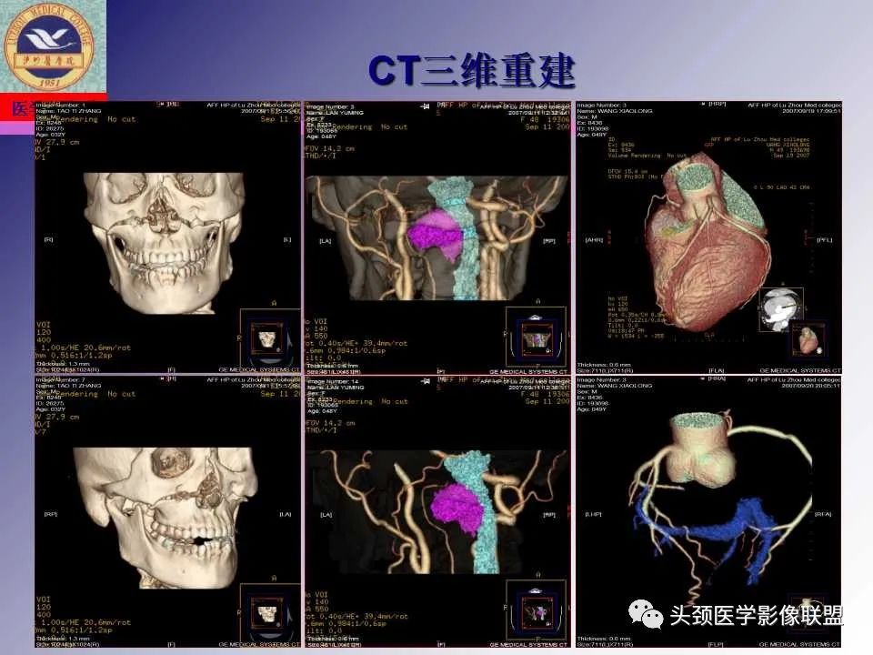 影像PPT - 【PPT】颌面部影像检查方法、正常表现及颌骨骨折影像表现-24