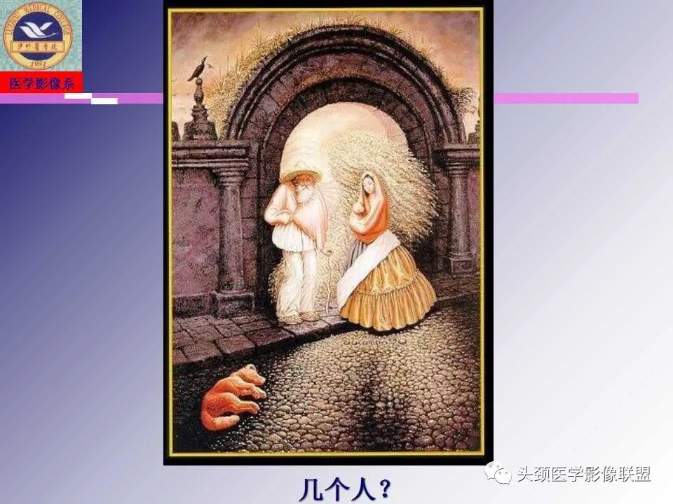 影像PPT - 【PPT】颌面部影像检查方法、正常表现及颌骨骨折影像表现-30