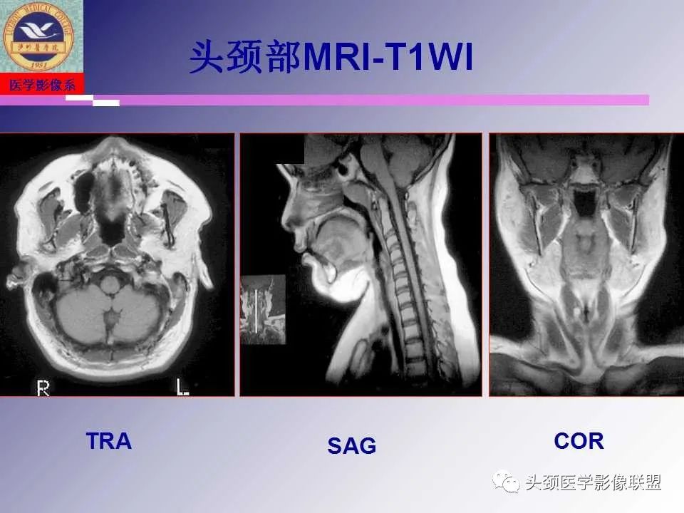 影像PPT - 【PPT】颌面部影像检查方法、正常表现及颌骨骨折影像表现-33