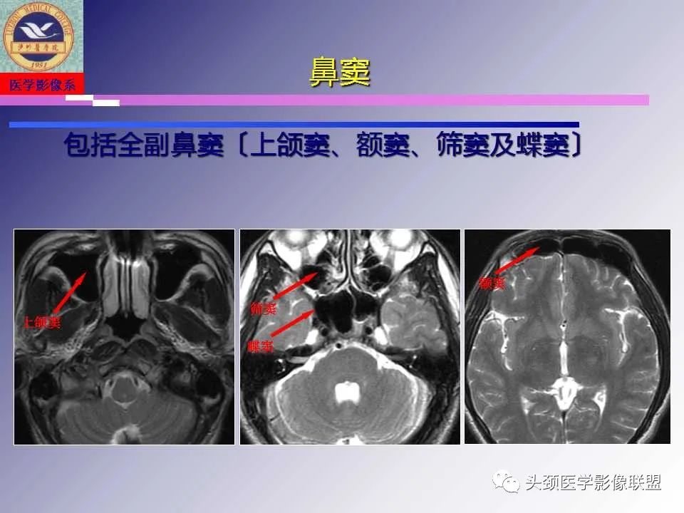 影像PPT - 【PPT】颌面部影像检查方法、正常表现及颌骨骨折影像表现-34