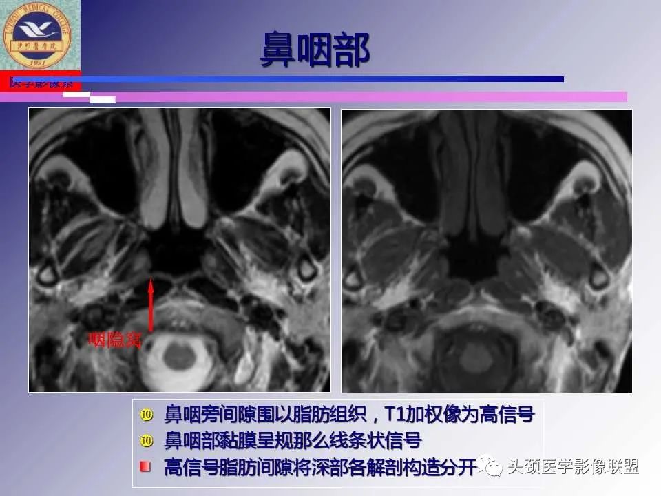 影像PPT - 【PPT】颌面部影像检查方法、正常表现及颌骨骨折影像表现-36