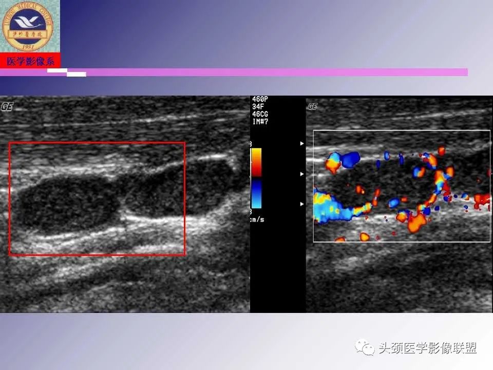 影像PPT - 【PPT】颌面部影像检查方法、正常表现及颌骨骨折影像表现-40