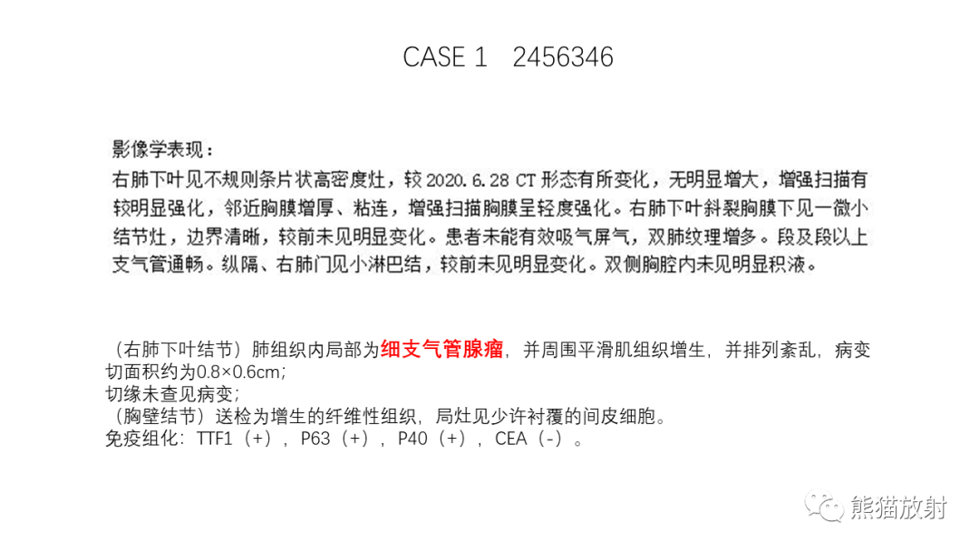 影像PPT - 【病例】支气管腺瘤2例CT影像-17