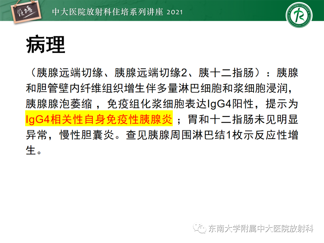 影像PPT - 【PPT】胆管细胞癌的影像表现与鉴别-40