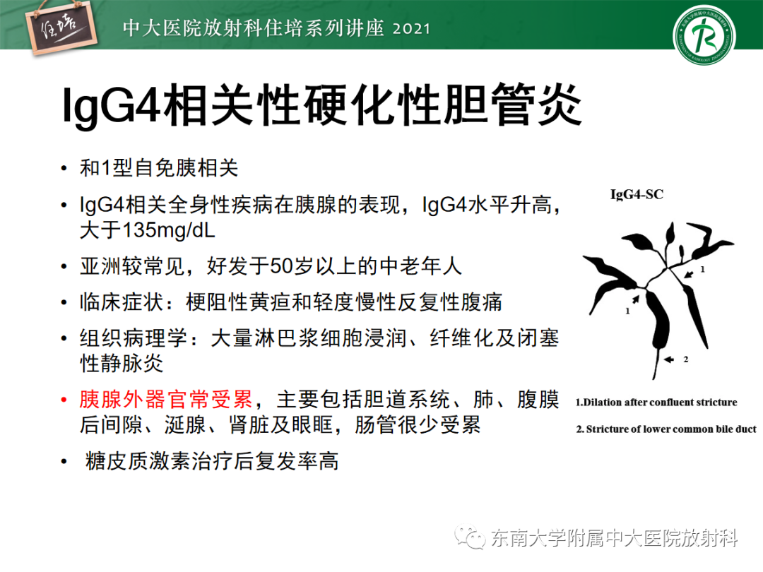 影像PPT - 【PPT】胆管细胞癌的影像表现与鉴别-44