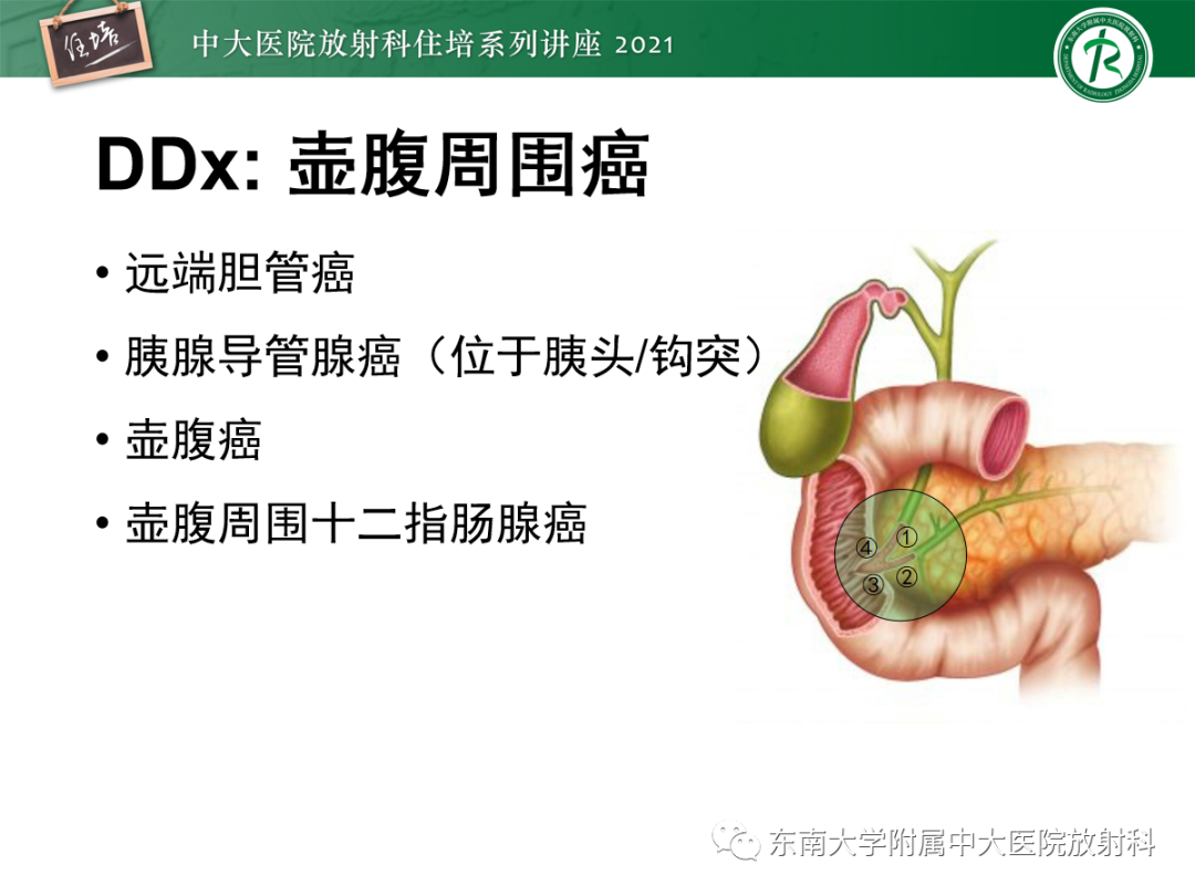 影像PPT - 【PPT】胆管细胞癌的影像表现与鉴别-47