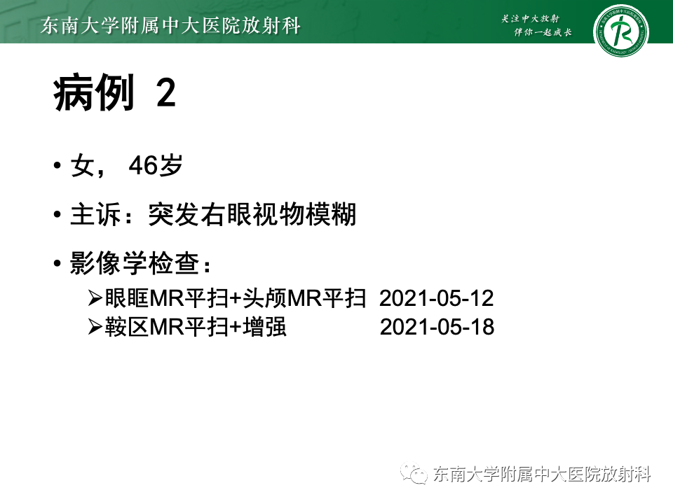 影像PPT - 【PPT】千变万化脑膜瘤-5