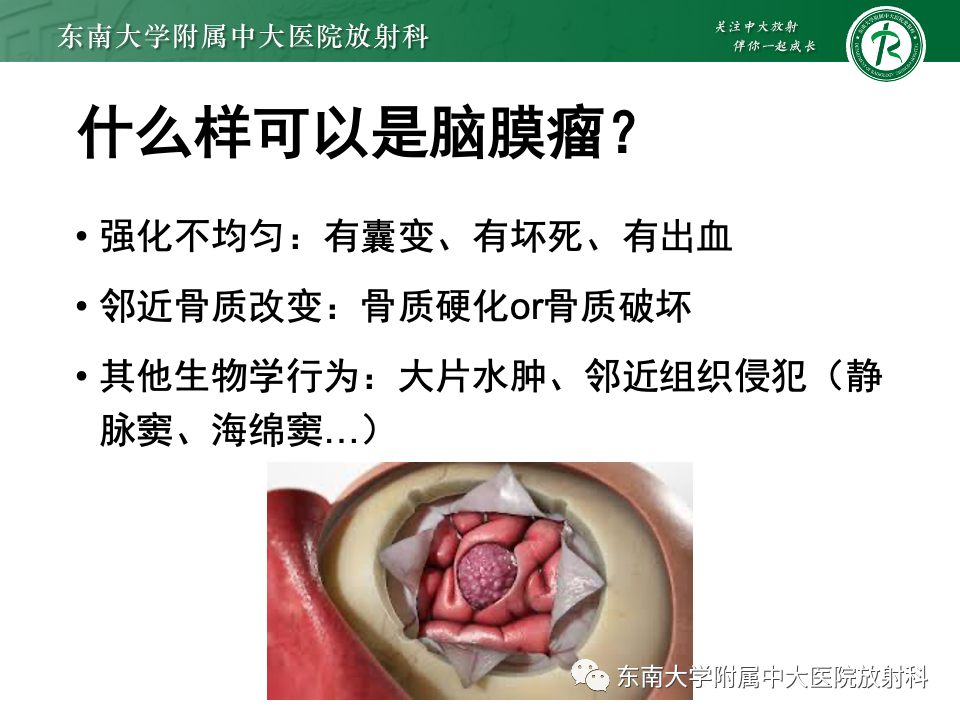 影像PPT - 【PPT】千变万化脑膜瘤-23