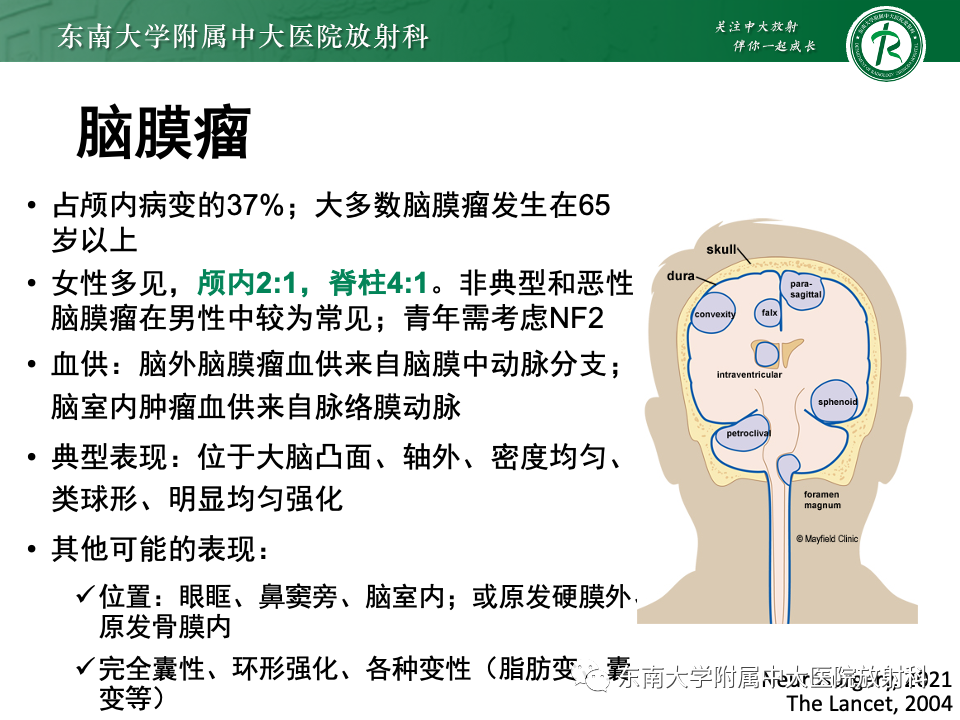 影像PPT - 【PPT】千变万化脑膜瘤-24