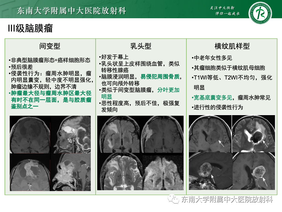 影像PPT - 【PPT】千变万化脑膜瘤-32