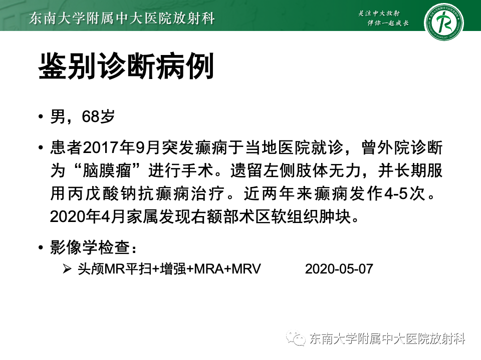 影像PPT - 【PPT】千变万化脑膜瘤-36
