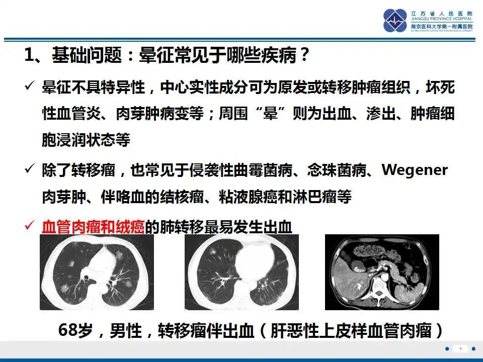 影像PPT - 【PPT】原发性纵隔绒毛膜癌-8