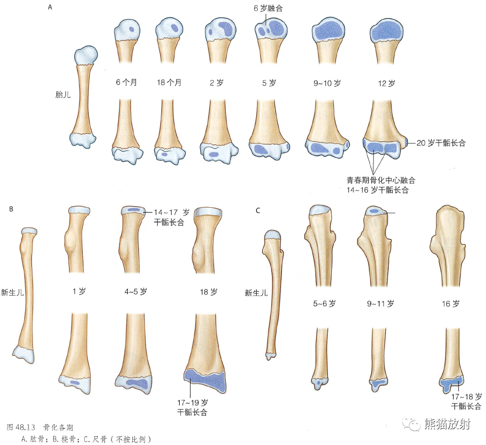 影像PPT - 肩及上肢解剖(上/前臂、手、肘/腕)-13 影像PPT - 肩及上肢解剖(上/前臂、手、肘/腕)-13