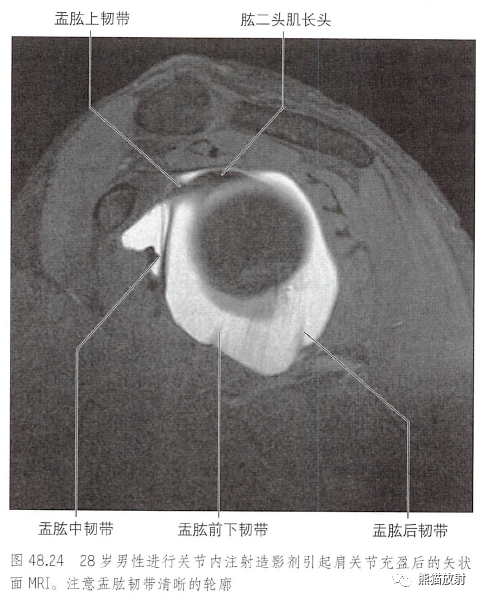 影像PPT - 肩及上肢解剖(上/前臂、手、肘/腕)-22 影像PPT - 肩及上肢解剖(上/前臂、手、肘/腕)-22