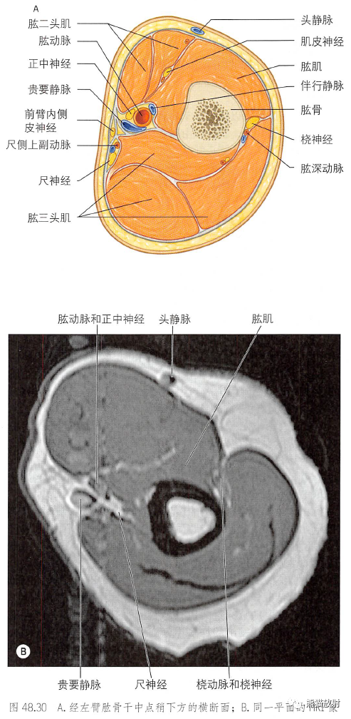 影像PPT - 肩及上肢解剖(上/前臂、手、肘/腕)-24 影像PPT - 肩及上肢解剖(上/前臂、手、肘/腕)-24