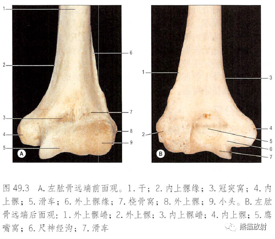 影像PPT - 肩及上肢解剖(上/前臂、手、肘/腕)-28 影像PPT - 肩及上肢解剖(上/前臂、手、肘/腕)-28