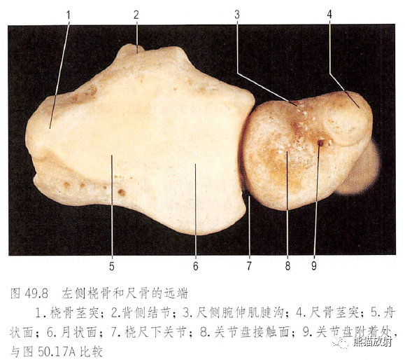 影像PPT - 肩及上肢解剖(上/前臂、手、肘/腕)-31 影像PPT - 肩及上肢解剖(上/前臂、手、肘/腕)-31